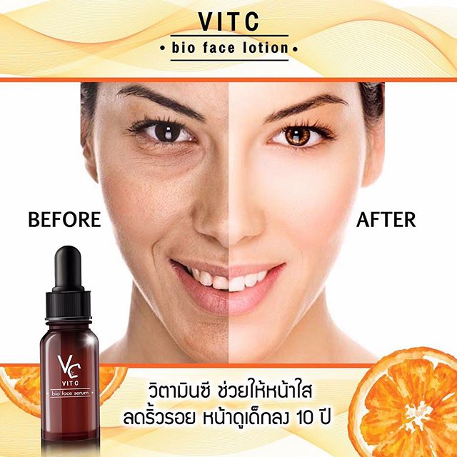 Vit C Bio Face Serum วีซีน้องฉัตร แพกเกจใหม่ล่าสุด