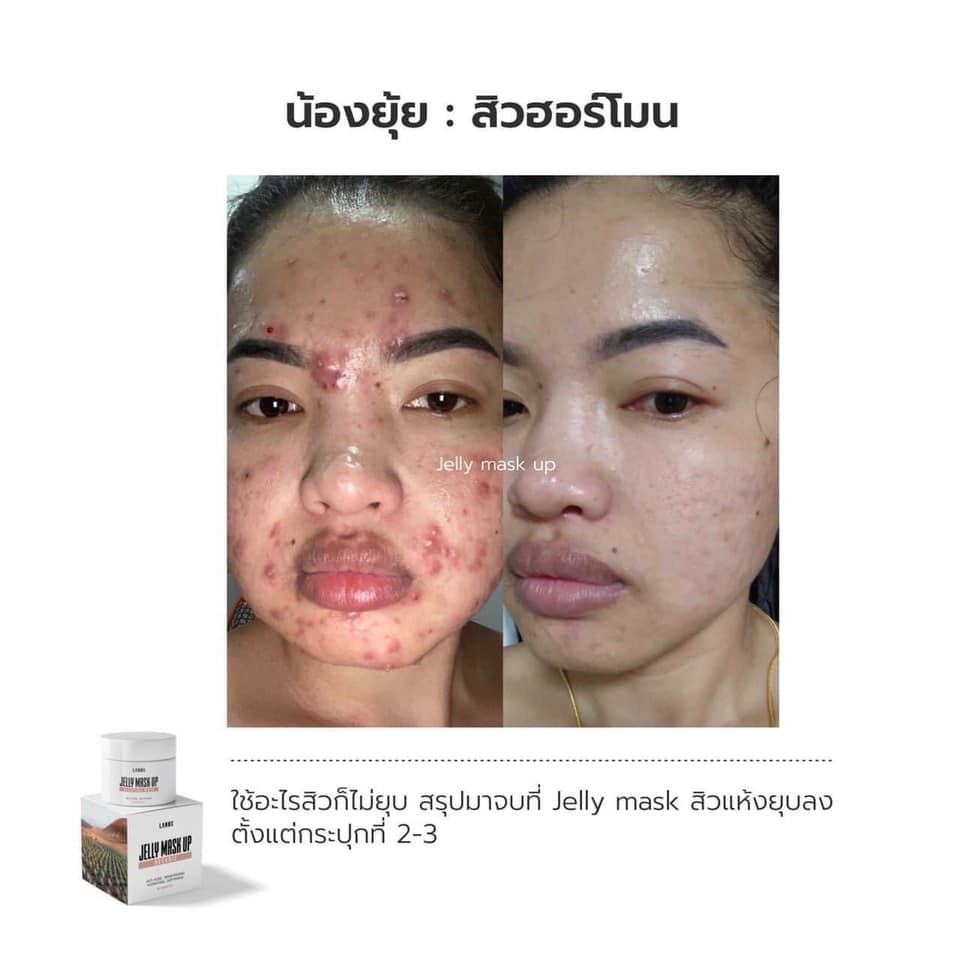 เจลลี่มาส์กอัพ Jelly Mask Up 20 กรัม Sleeping Mask LANOS แพกเกจใหม่ลล่าสุด