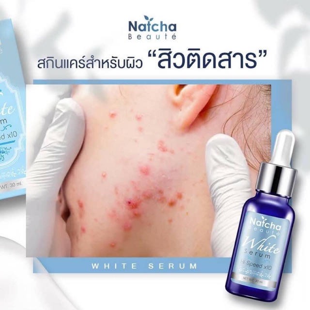 เซรั่มณัชชา natcha serum ณัชชาเซรั่ม เซรั่มรักษาฝ้า