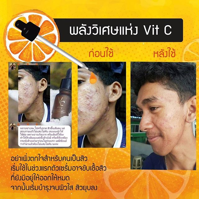 Vit C Bio Face Serum วีซีน้องฉัตร แพกเกจใหม่ล่าสุด