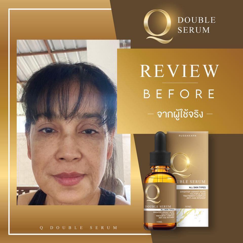 เซรั่มคิว ลดสิว ฝ้า กระ หน้าเด้ง 30ml. Q Double Serum