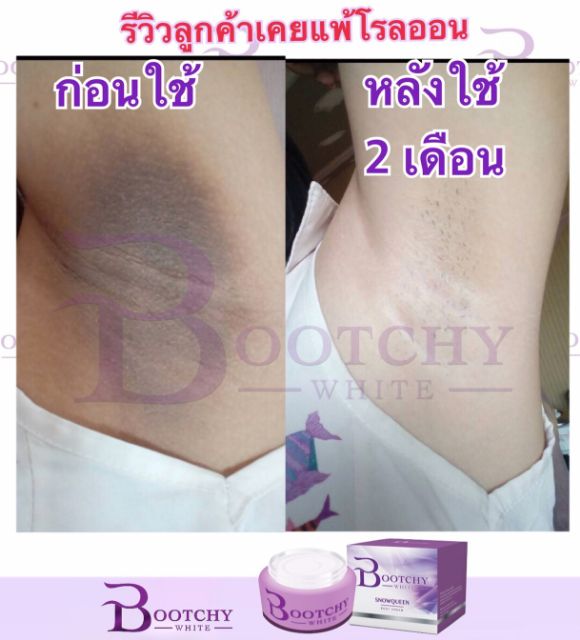 Bootchy White ครีมบุทชี่ไวท์