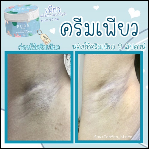 เพียว ครีมแก้ปัญหากลิ่นตัว Pure underarm 50 g.ครีมเพียว ทารักแร้ขาว