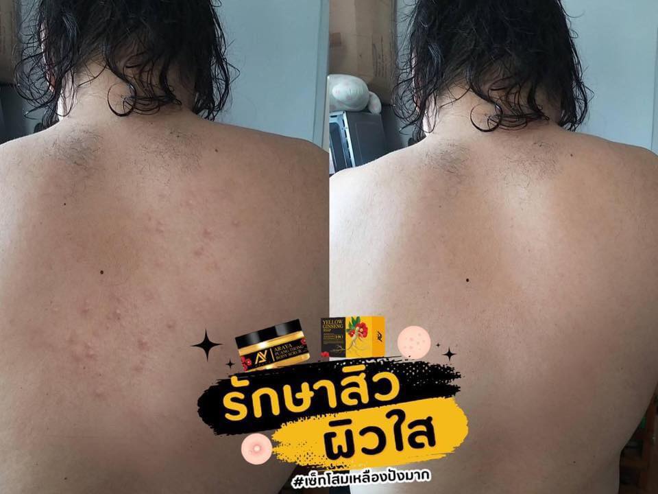 สครับผิว Araya พวงทอง บอดี้สครับ (แถมสบู่) 350 กรัม