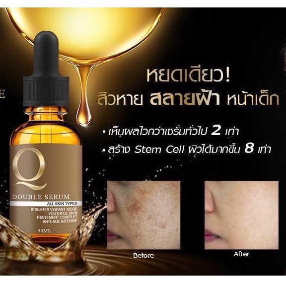 เซรั่มคิว ลดสิว ฝ้า กระ หน้าเด้ง 30ml. Q Double Serum