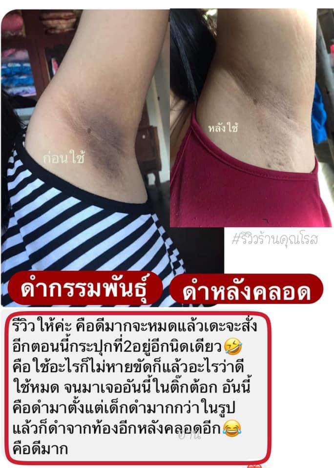 เพียว ครีมแก้ปัญหากลิ่นตัว Pure underarm 50 g.ครีมเพียว ทารักแร้ขาว