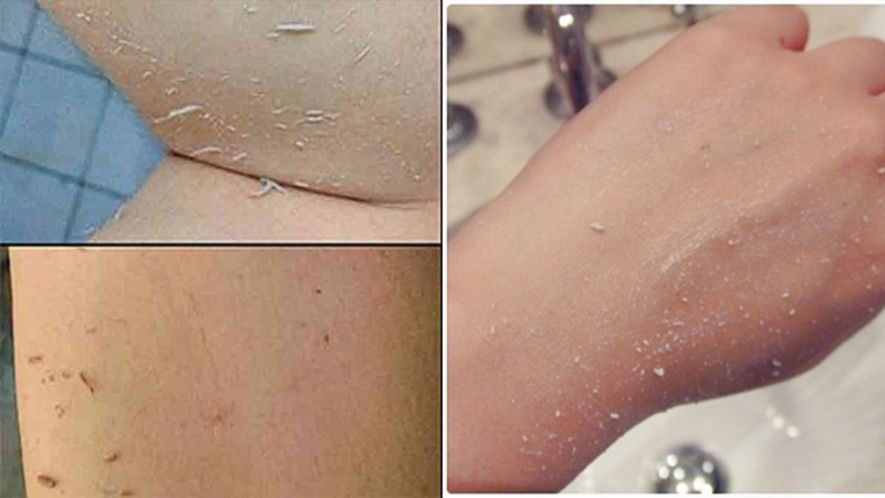 หินขัดตัว หินขัดขี้ไคล หินขัดผิว หินขัดส้นเท้า หินขัดเท้า