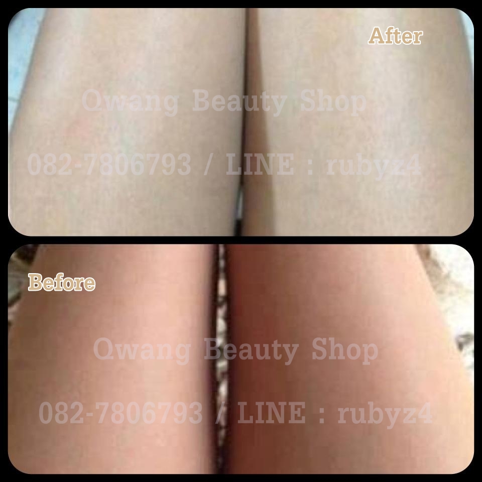 Set ขาวออร่า