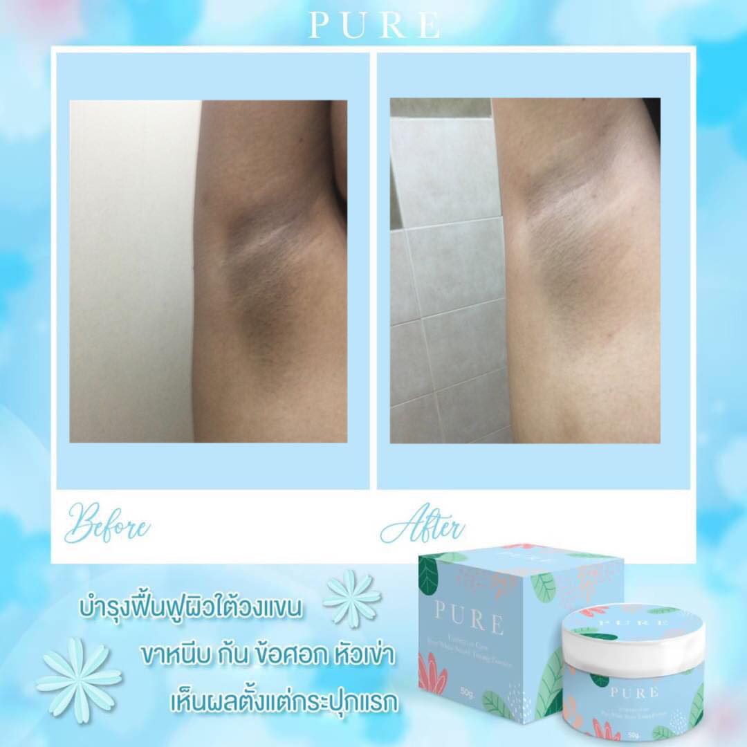 เพียว ครีมแก้ปัญหากลิ่นตัว Pure underarm 50 g.ครีมเพียว ทารักแร้ขาว