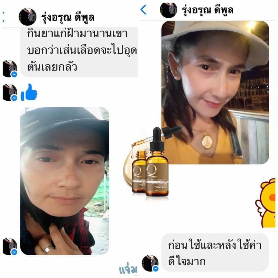 เซรั่มคิว ลดสิว ฝ้า กระ หน้าเด้ง 30ml. Q Double Serum