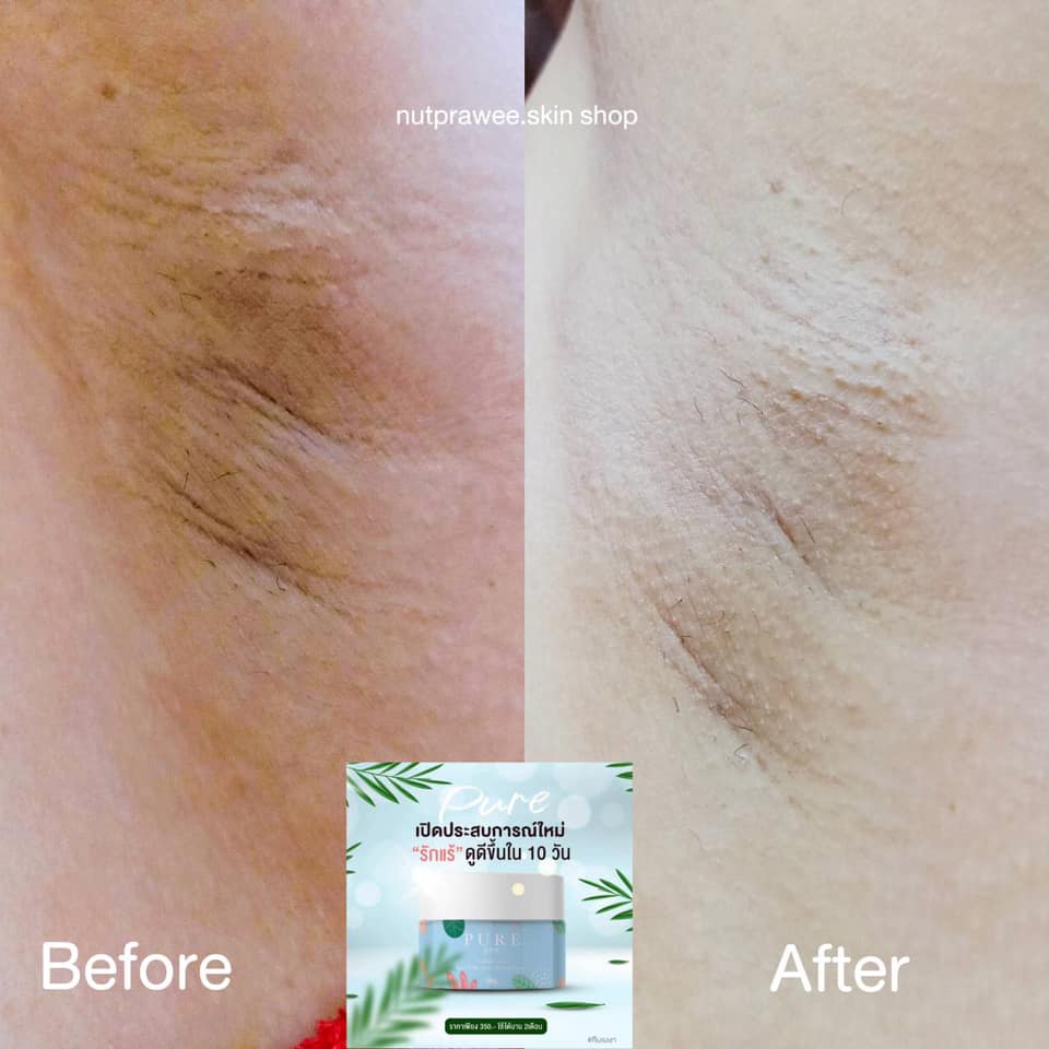 เพียว ครีมแก้ปัญหากลิ่นตัว Pure underarm 50 g.ครีมเพียว ทารักแร้ขาว