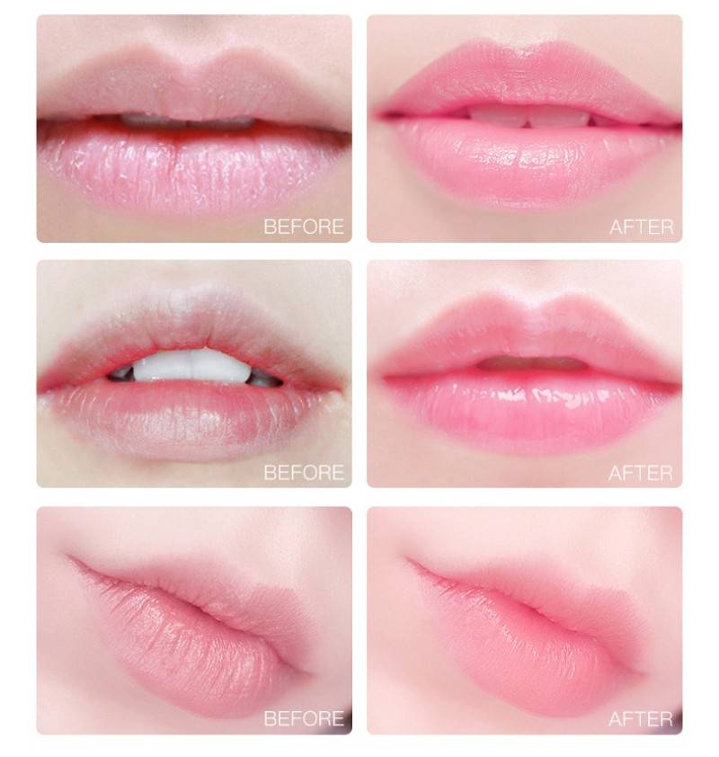 แผ่นมาร์คปาก ZOZU มาร์คปากคอลลาเจน 20แผ่น 60g LIP MASK
