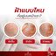 เซรั่มมัทนา Matana angel rose drop essence เซรั่มกุหลาบ (30 ml.)